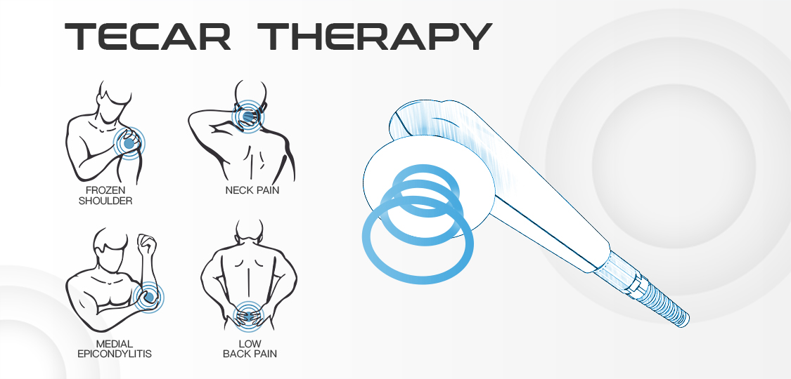 TECAR therapy uses radiofrequency energy to promote tissue repair, reduce pain, and improve range of motion, with Capacitive mode for soft tissues and Resistive mode for deeper tissues.